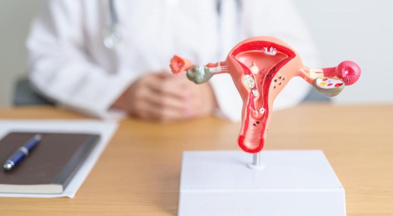 Bingung Bedakan PCOS dan PMOS? Ini Penjelasan Dokter yang Mudah Dipahami